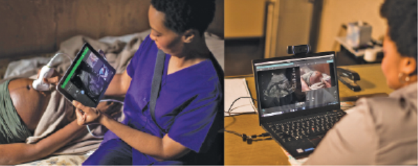 Lumify features a cloud-based collaborative platform that brings experts into an ultrasound exam, no matter the distance, as though they were in the same room